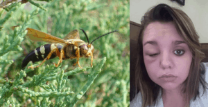 bee sting Rochester NY