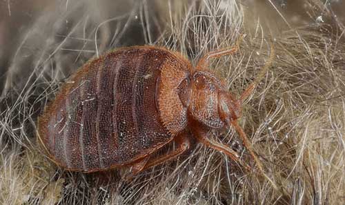bed bug in hair