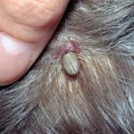 tick engorged in scalp